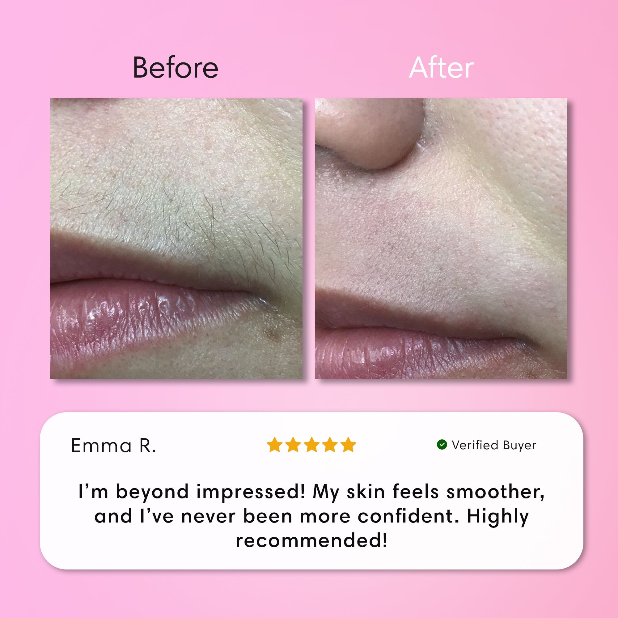 Opulenza Smooth Skin Kit
