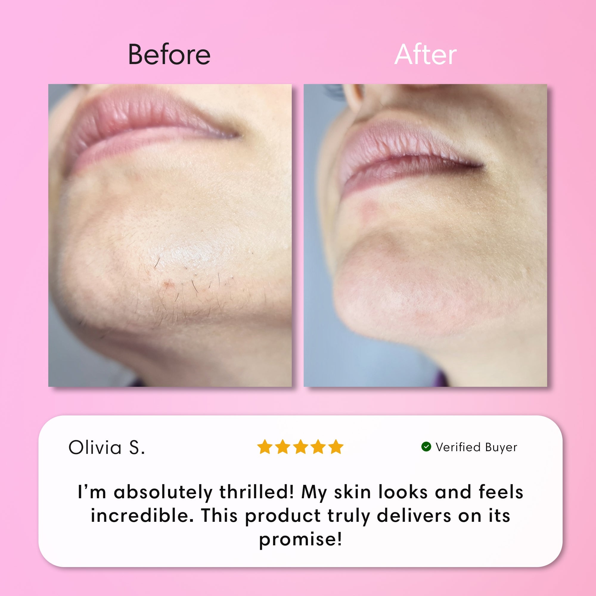 Opulenza Smooth Skin Kit